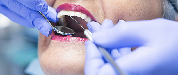 Best Emergency Wisdom Tooth Extraction in San Elizario, TX